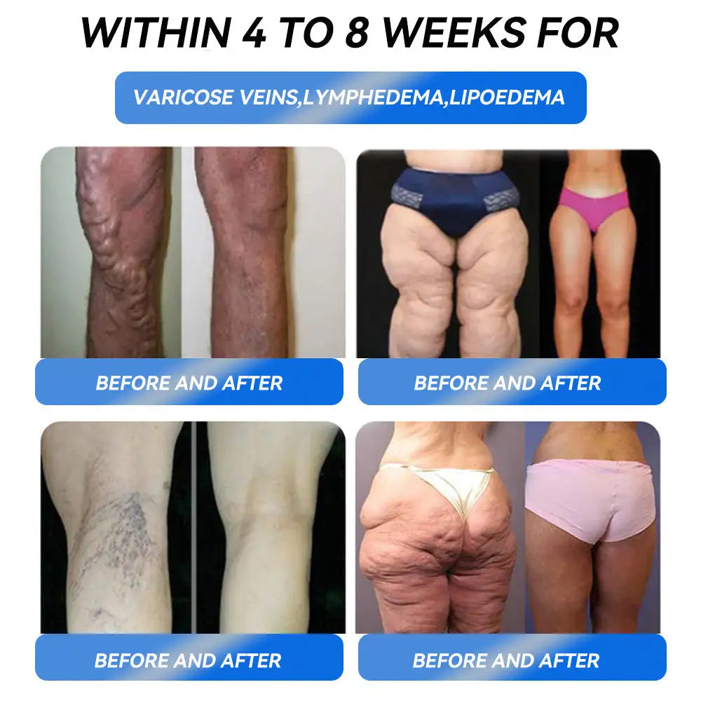 IFMAGIC® GLP-1 Pro Oral Solution for Weight Loss One dose per day – Visible results within 7 days Suitable for obesity, cardiovascular diseases, diabetes, sleep apnea, high cholesterol, high blood fats, joint problems, and more 🚀