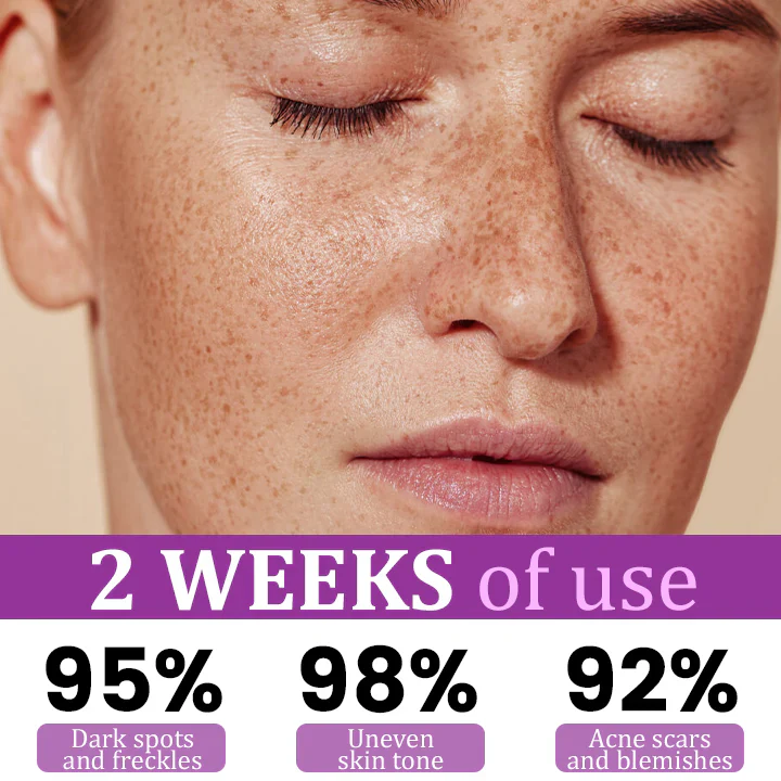 Fivfivgo® MelantraX Advanced Anti-Hyperpigmentation Essence