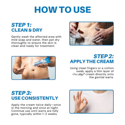Oveallgo® HPV Genital Warts Relief Cream